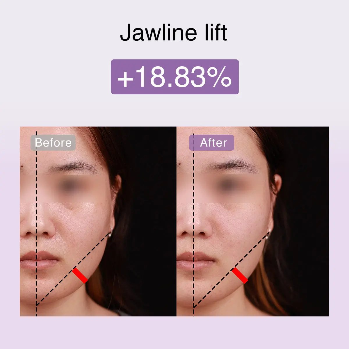 DermRays FusionGlow Multi-Functional Microcurrent Facial Toning Device DermRays DermRays