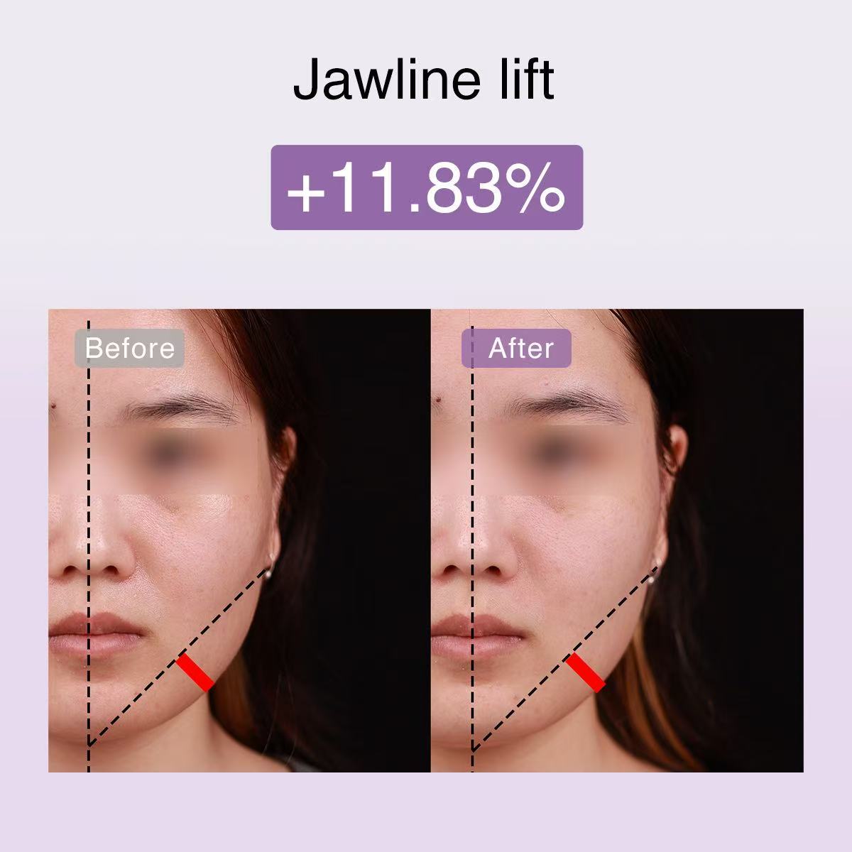 DermRays FusionGlow Multi-Functional Microcurrent Facial Toning Device DermRays DermRays
