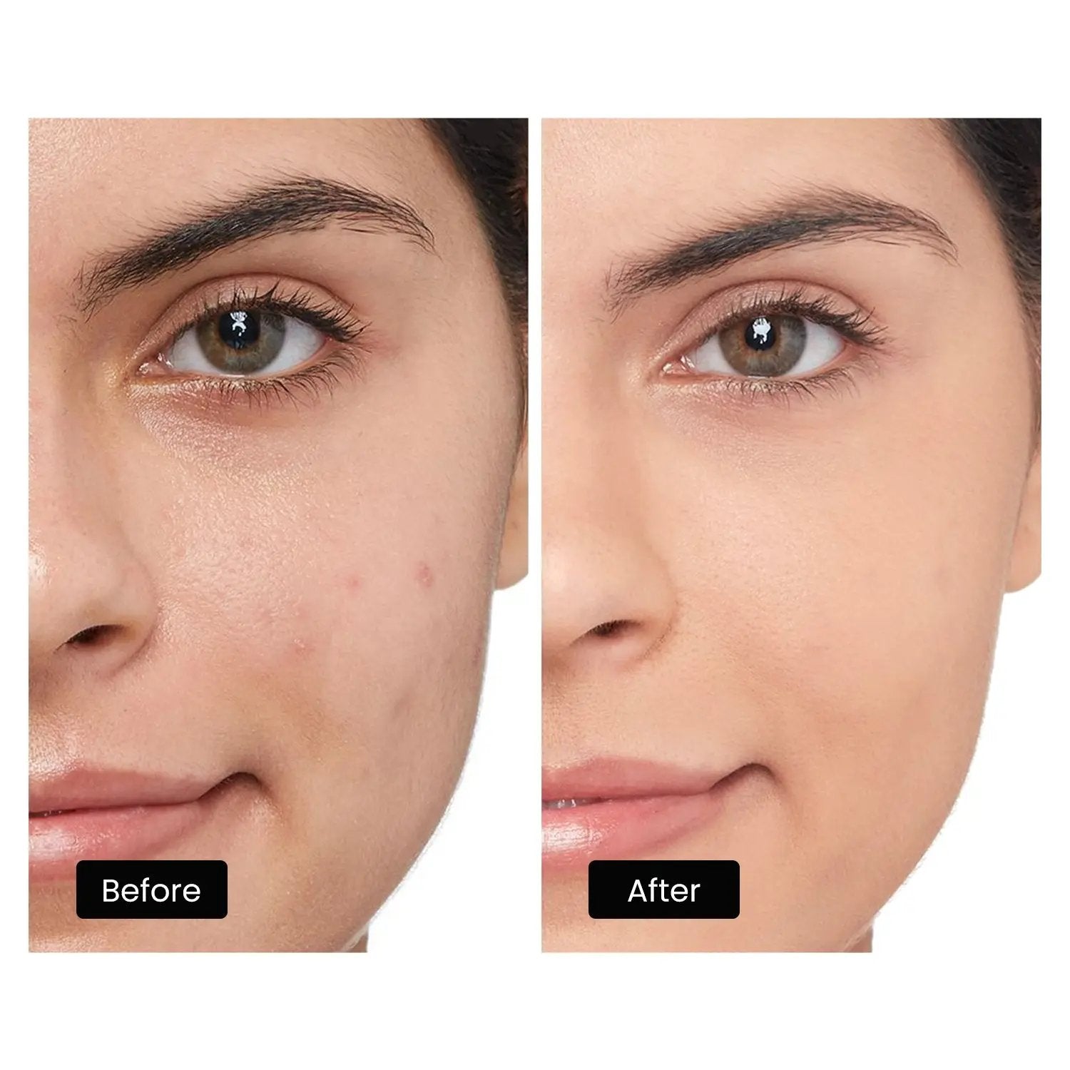 DermRays LED Light Therapy Mask For Face, Neck and Décolletage, Revitalize & Renew Your Skin DermRays DermRays