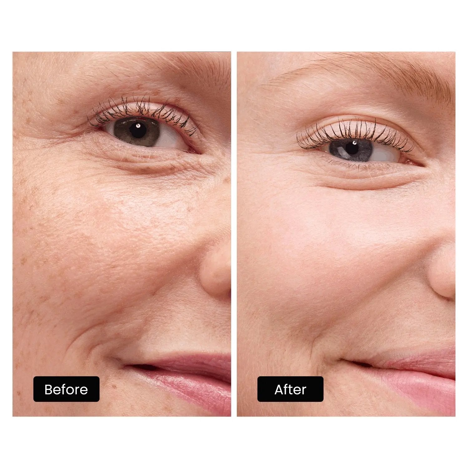 DermRays LED Light Therapy Mask For Face, Neck and Décolletage, Revitalize & Renew Your Skin DermRays DermRays