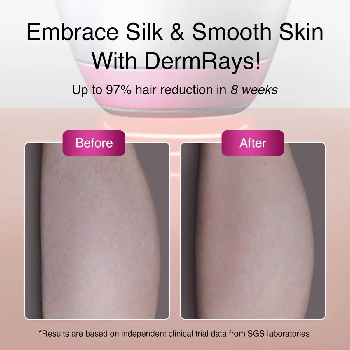 DermRays V6S Diode Laser Hair Removal, 1064nm, Specifically For Dark Skin Dermrays DermRays