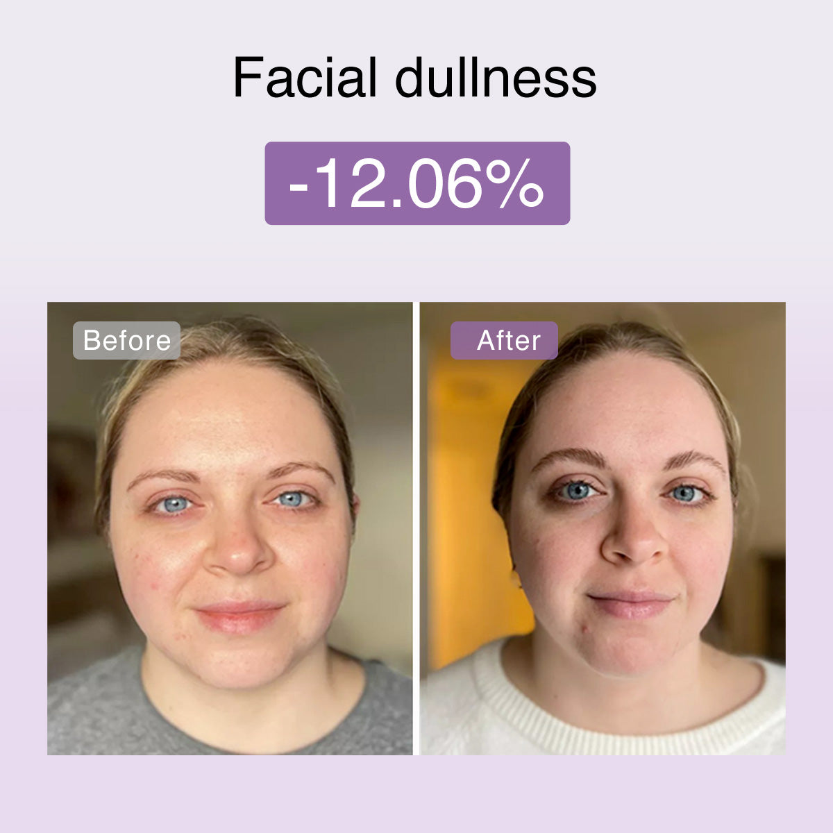 Dispositivo tonificante facial de microcorriente multifuncional DermRays FusionGlow