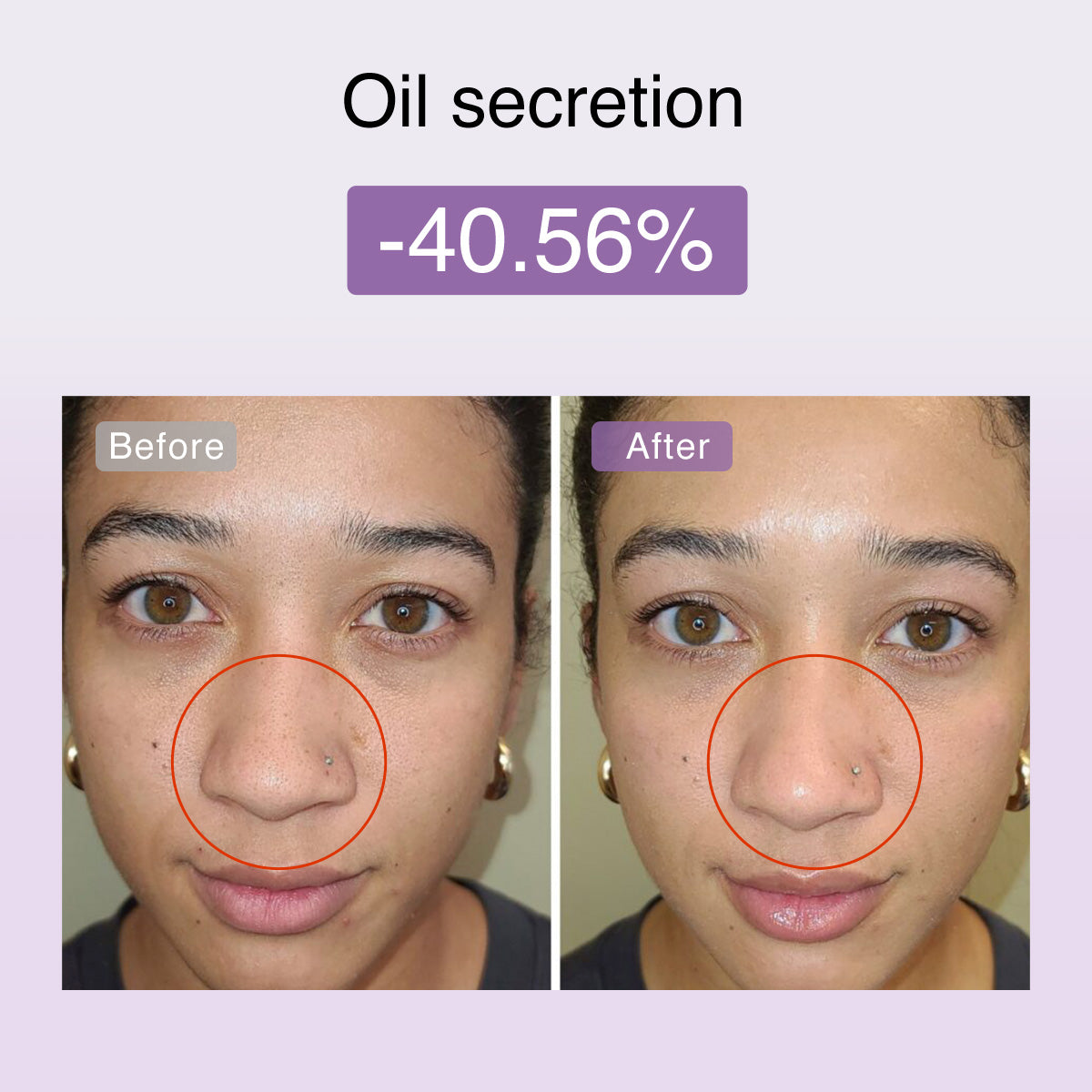 Dispositivo tonificante facial de microcorriente multifuncional DermRays FusionGlow