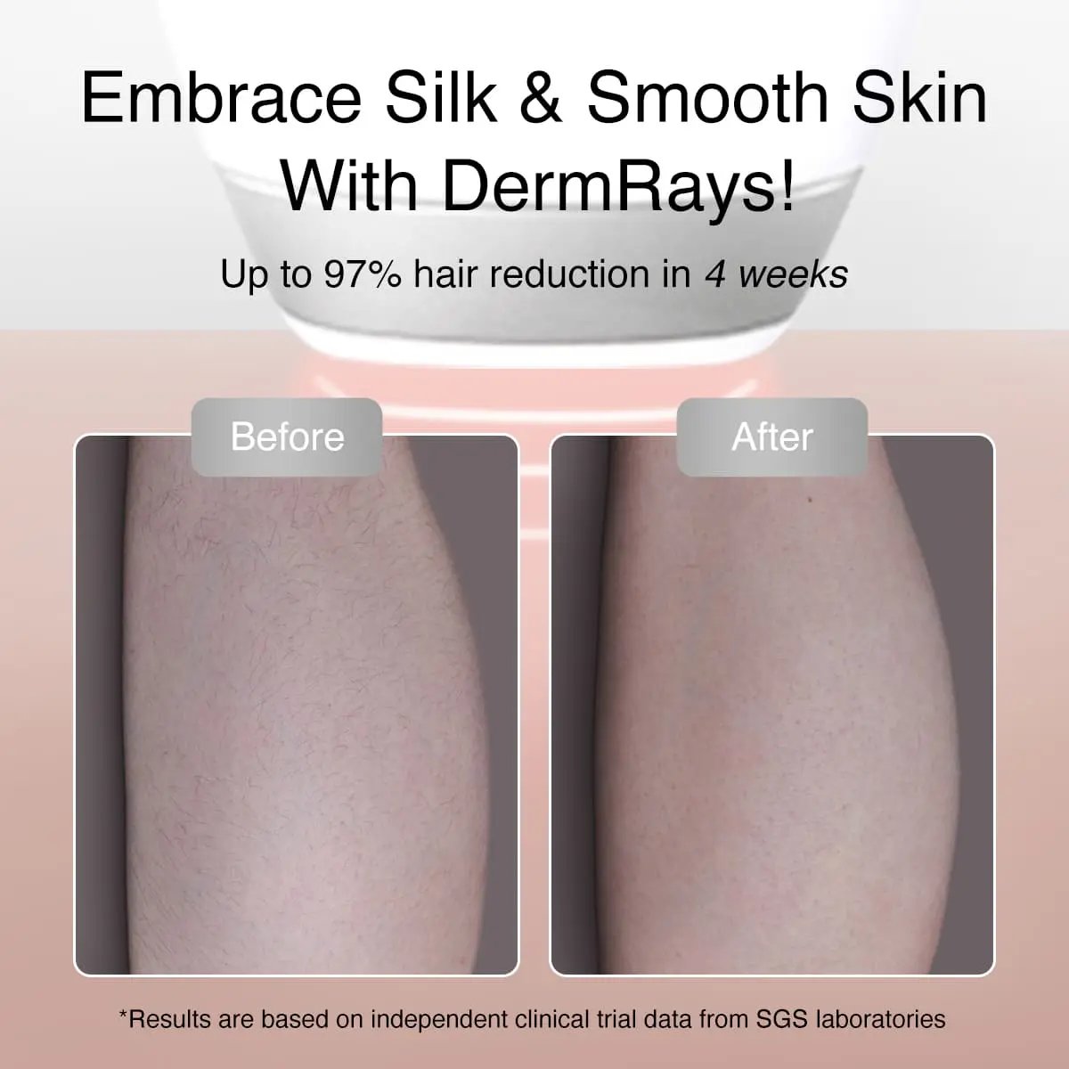 DermRays V8S Diode Laser Hair Removal, 810nm, Faster Results, Most Powerful