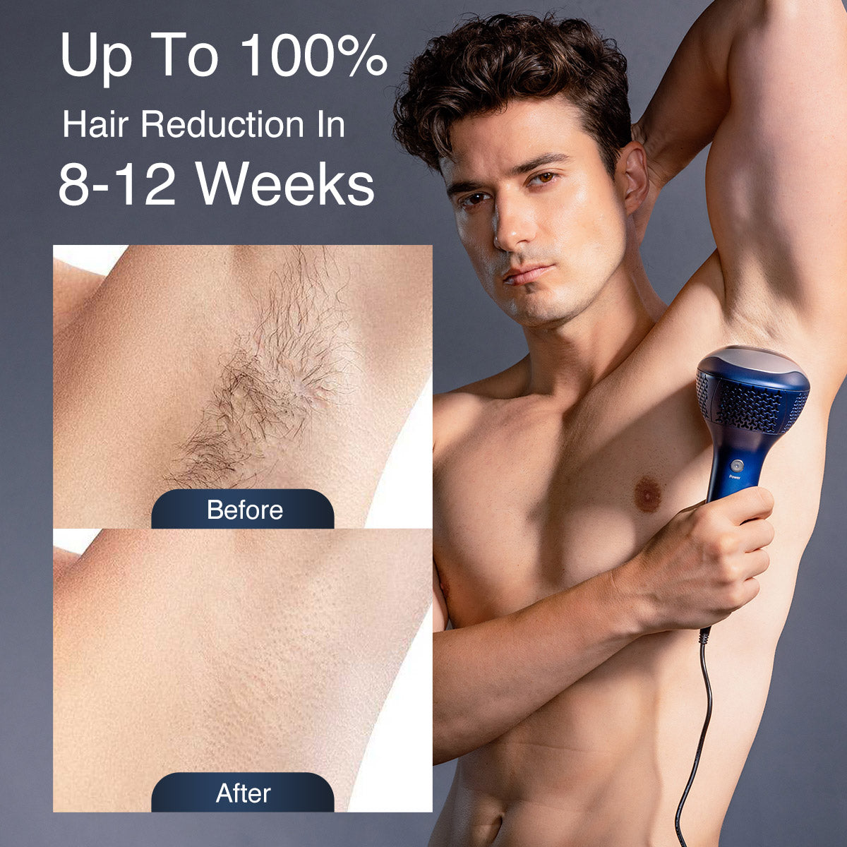 DermRays V10S Diode Laser Hair Removal, Pro-level cooling, Target Thick Hair with Precision