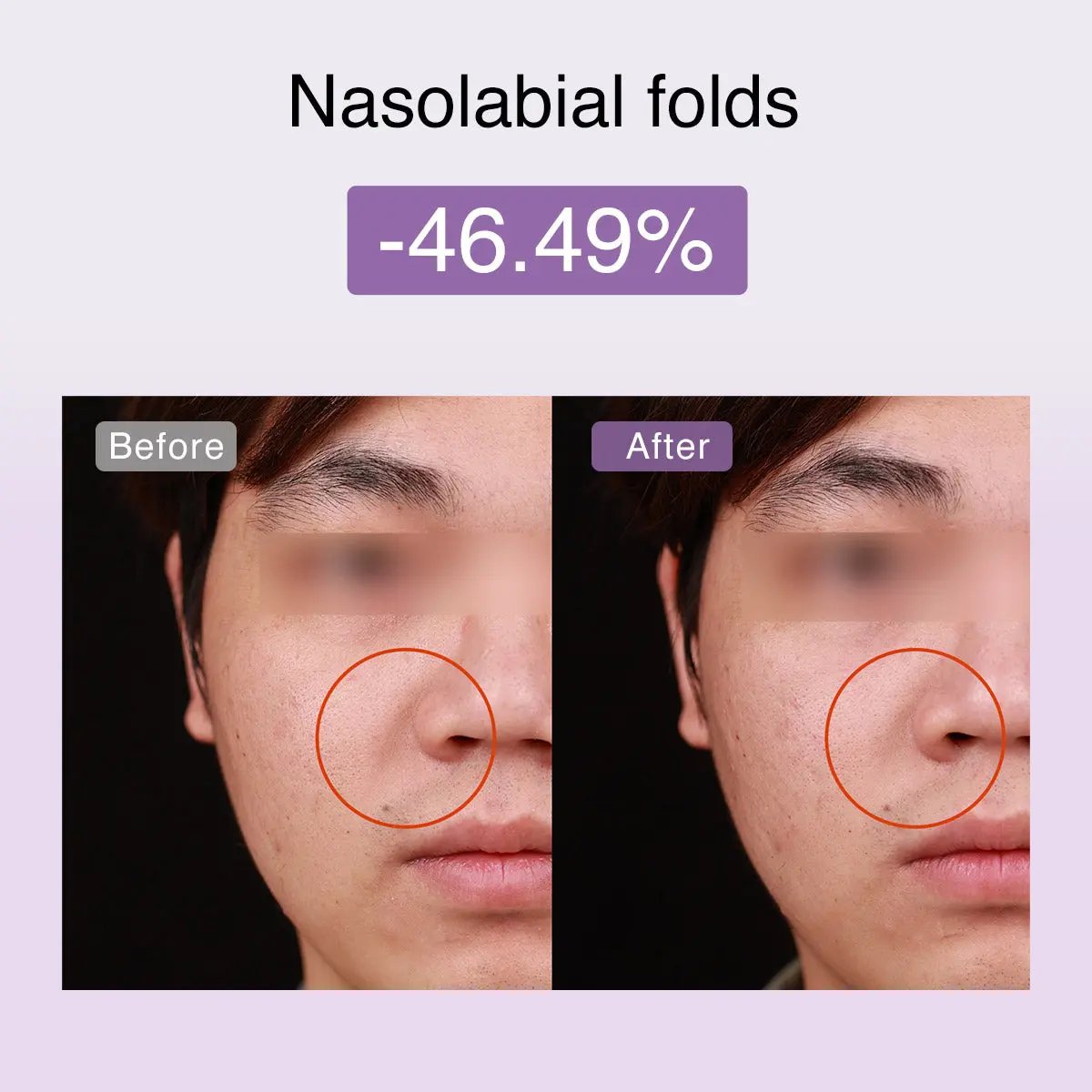 DermRays FusionGlow Multi-Functional Microcurrent Facial Toning Device DermRays