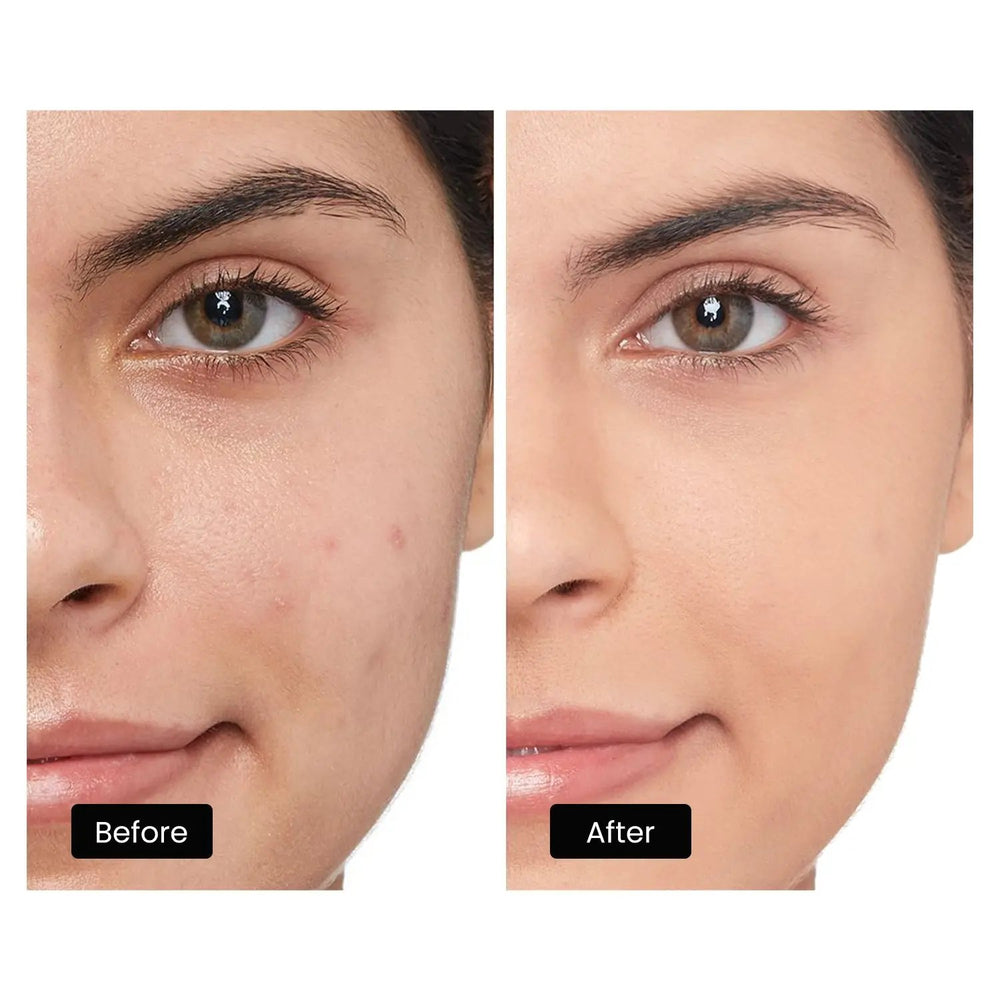 DermRays LED Light Therapy Mask For Face, Neck and Décolletage, Revita