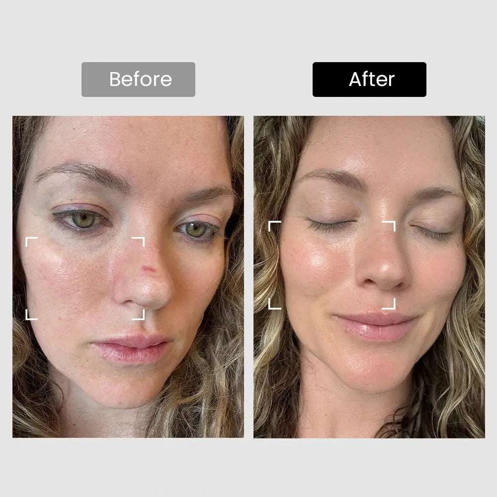 DermRays Revive Skincare Laser for Anti-Aging, Glow Like Never Before Dermrays DermRays