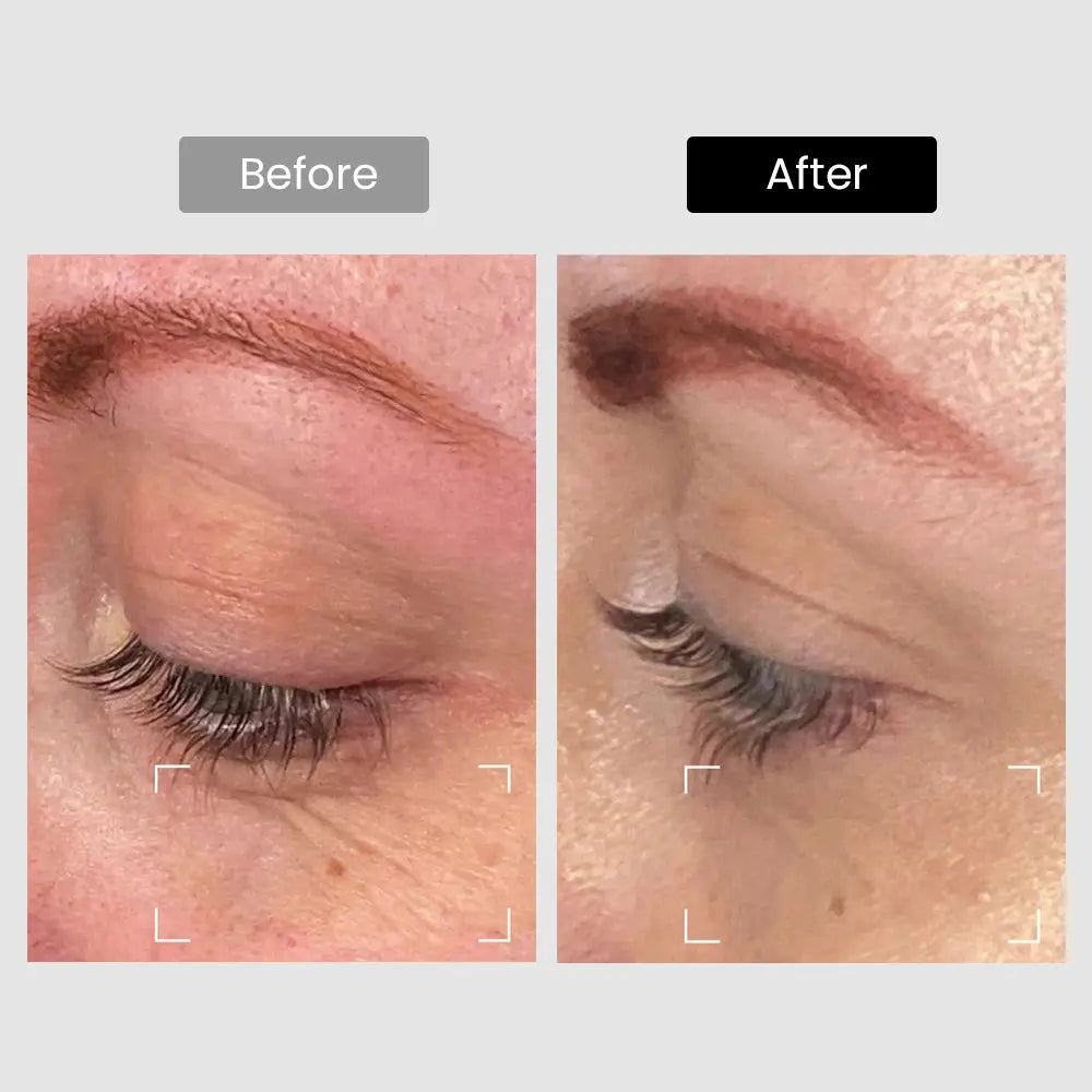 DermRays Revive Skincare Laser for Anti-Aging, Glow Like Never Before Dermrays DermRays