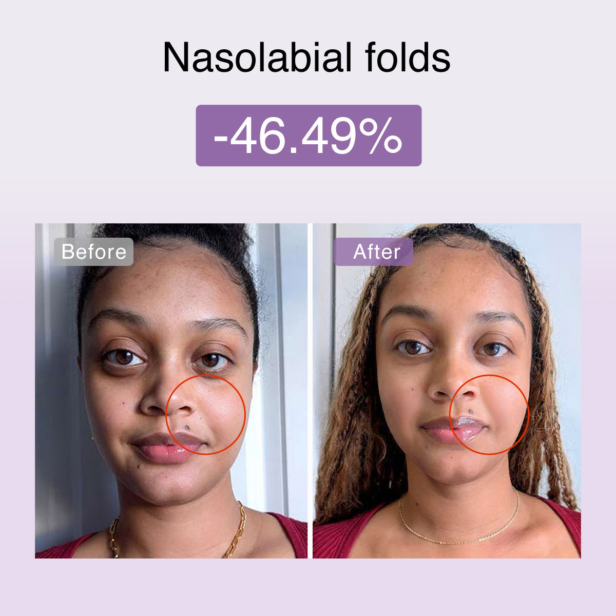 Dispositivo tonificante facial de microcorriente multifuncional DermRays FusionGlow