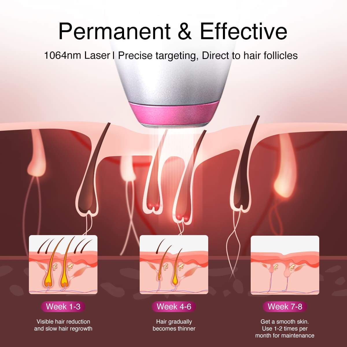 DermRays V6S Diode Laser Hair Removal, 1064nm, Specifically For Deep Skin