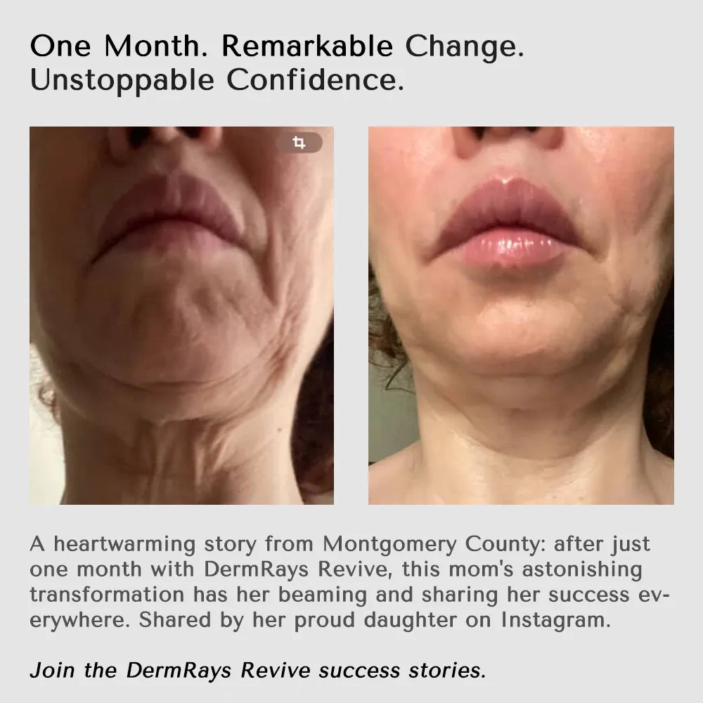 DermRays Revive Skincare Laser for Anti-Aging, Glow Like Never Before