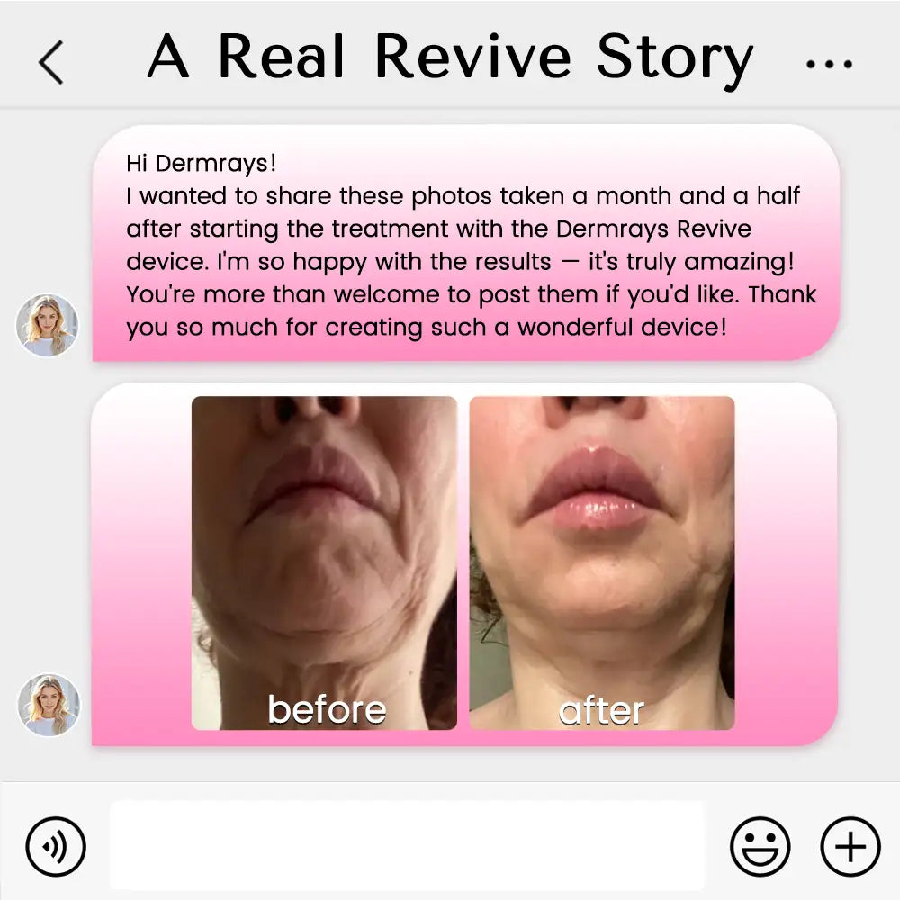 DermRays Revive Skincare Laser for Anti-Aging, Glow Like Never Before
